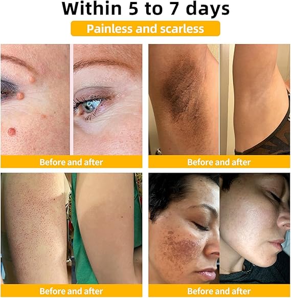 Bee Venom Skin Care Cream